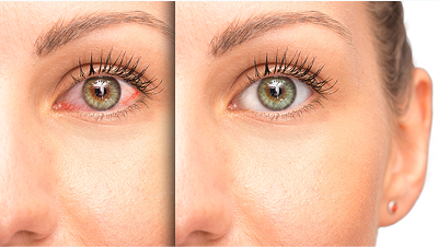 ممارسة التمارين الرياضية